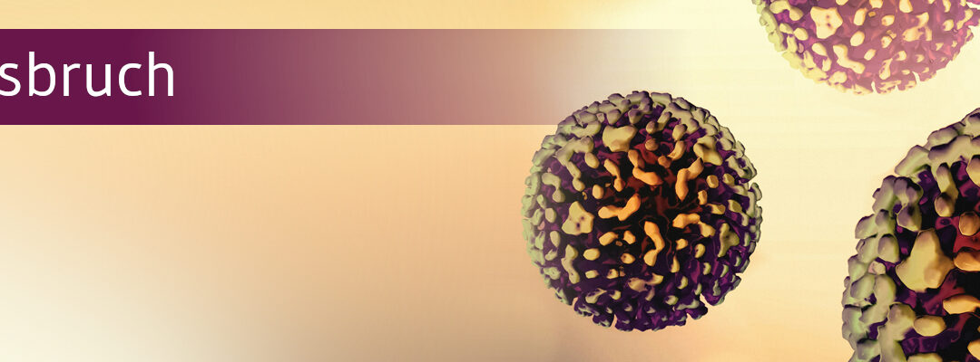 Hepatitis A: Massiver Ausbruch in Tschechien