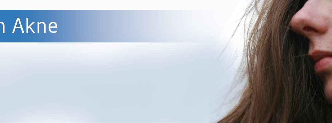 Impfstoffe gegen Akne in Sicht