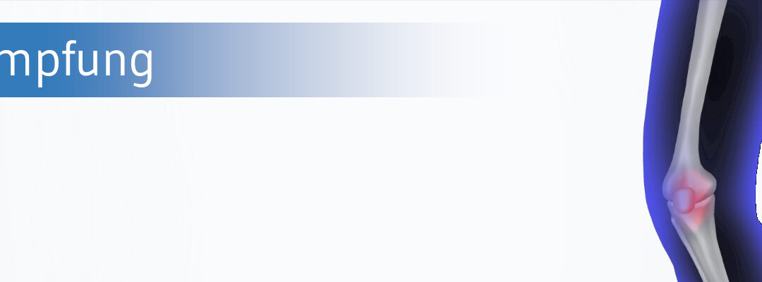 Eine Impfung gegen Kniearthrose?